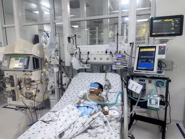 Bé trai nguy kịch sau khi bị ong vò vẽ đốt 70 vết. Ảnh: BVCC Bé trai nguy kịch sau khi bị ong vò vẽ đốt 70 vết. Ảnh: BVCC