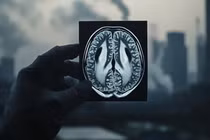 Ô nhiễm không khí làm tăng nguy cơ mắc bệnh Parkinson và các bệnh thần kinh