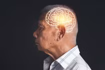 Chỉ cần 3.000 bước mỗi ngày để bảo vệ não khỏi Alzheimer