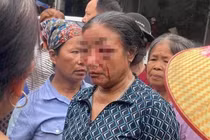 Giao công an xác minh thông tin người phụ nữ bán rau bị xịt nước chảy máu mặt
