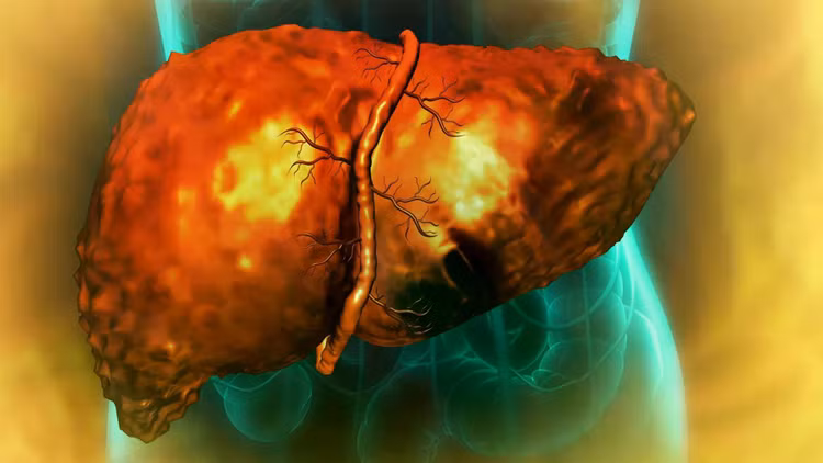liver-damage.jpg