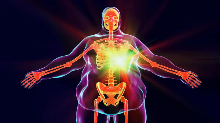 heart-disease-in-obesity-anatomy-crop.jpg