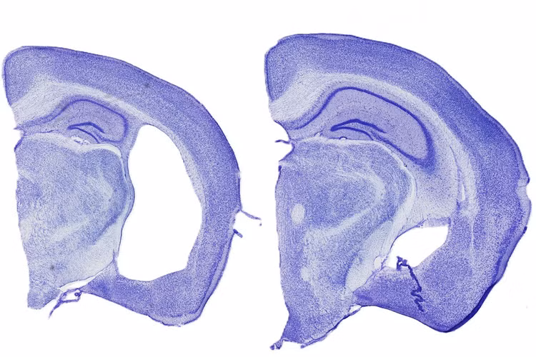 tau-mouse-brain.jpg