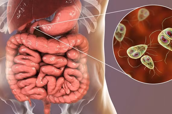 Công nghệ probiotic biến đổi gene mở ra tương lai điều trị tiểu đường