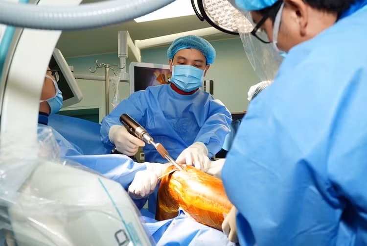 Theo thông tin từ bệnh viện, các bác sĩ đã quyết định thực hiện phương pháp phẫu thuật kết hợp xương kín bằng đinh nội tủy có chốt dưới màn hình tăng sáng. Đây là giải pháp phẫu thuật ít xâm lấn, giúp giảm thiểu tổn thương mô mềm và đảm bảo phục hồi nhanh chóng. Lúc 20h18, các bác sĩ bắt đầu thực hiện ca phẫu thuật và kết thúc lúc 21h43. Sau mổ, Xuân Son sẽ được chuyển sang khu vực hồi sức tích cực để theo dõi và đánh giá tình trạng.