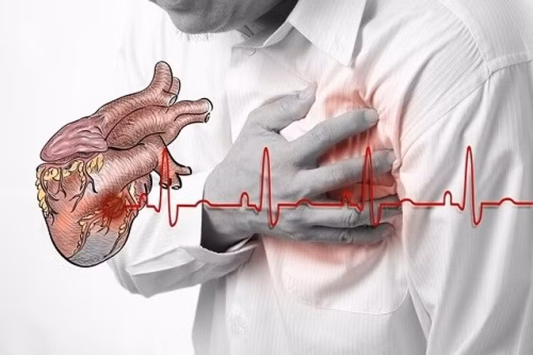 Triệu chứng nhồi máu cơ tim cấp rất đa dạng nhưng điển hình là đau ngực và khó thở - Ảnh minh hoạ Triệu chứng nhồi máu cơ tim cấp rất đa dạng nhưng điển hình là đau ngực và khó thở - Ảnh minh hoạ