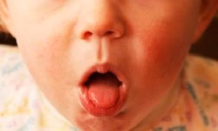 Trường hợp trẻ bị ho gà không được điều trị đúng có thể dẫn tới một số biến chứng nguy hiểm - Ảnh minh hoạ Trường hợp trẻ bị ho gà không được điều trị đúng có thể dẫn tới một số biến chứng nguy hiểm - Ảnh minh hoạ