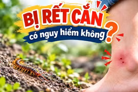 Bác sĩ hướng dẫn sơ cứu khi bị rết cắn để hạn chế nguy hiểm