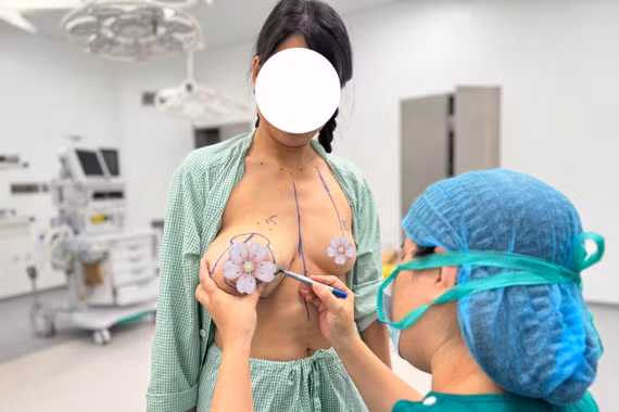 Người phụ nữ mắc u vú phát triển hơn 1kg do trì hoãn khám bệnh