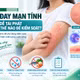 Mày đay mạn tính tái phát: Đừng vội đổ lỗi cho thời tiết, gan mật