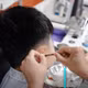 Dị tật tai bẩm sinh, trẻ 12 tuổi bị cholesteatoma đã lan vào xương chũm