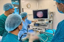 Bé sơ sinh 32 ngày tuổi mắc u nang hố lưỡi thanh thiệt khổng lồ hiếm gặp