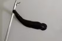 Con đỉa 4 cm sống ký sinh trong mũi bệnh nhi ở Quảng Trị