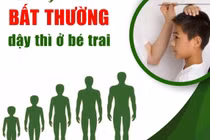 Bác sĩ chỉ cách phát hiện những bất thường khi bé trai dậy thì