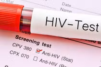 Công nghệ enzyme CRISPR mới giúp phát hiện HIV nhanh và chính xác hơn