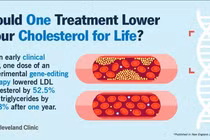 Chỉnh sửa gen giúp điều trị lâu dài cholesterol cao