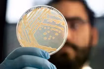 Các nhà khoa học đã nuôi cấy các quần thể (trong ảnh) từ bốn loài nấm men tìm thấy trên cơ thể xác ướp. Nguồn: Eurac Research/Andrea De Giovanni