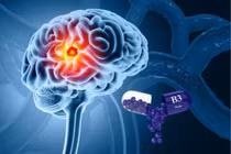 Phát hiện Vitamin B3 có tiềm năng hỗ trợ điều trị ung thư não glioblastoma