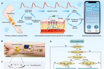 Thử nghiệm thiết bị cấy ghép loại bỏ glucose không dùng thuốc