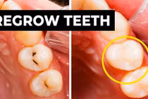 Phát minh gel tái tạo men răng giúp bảo vệ sức khỏe răng miệng