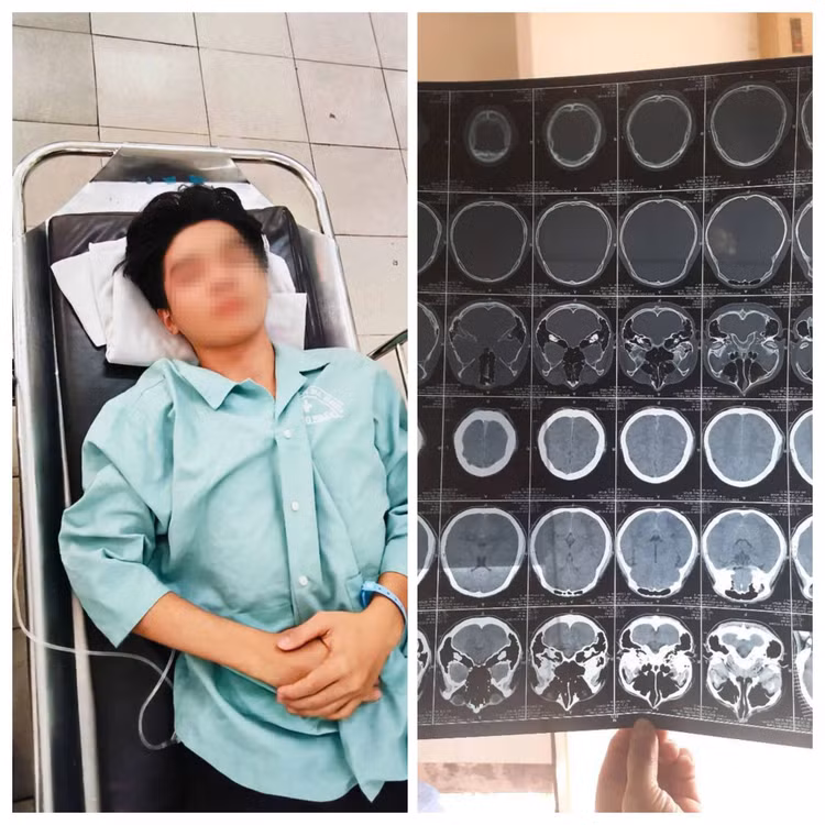 Vụ nam sinh bị hành hung nứt sọ não: Nghi do mâu thuẫn tình cảm - Hình 2 Vu nam sinh bi hanh hung nut so nao: Nghi do mau thuan tinh cam-Hinh-2