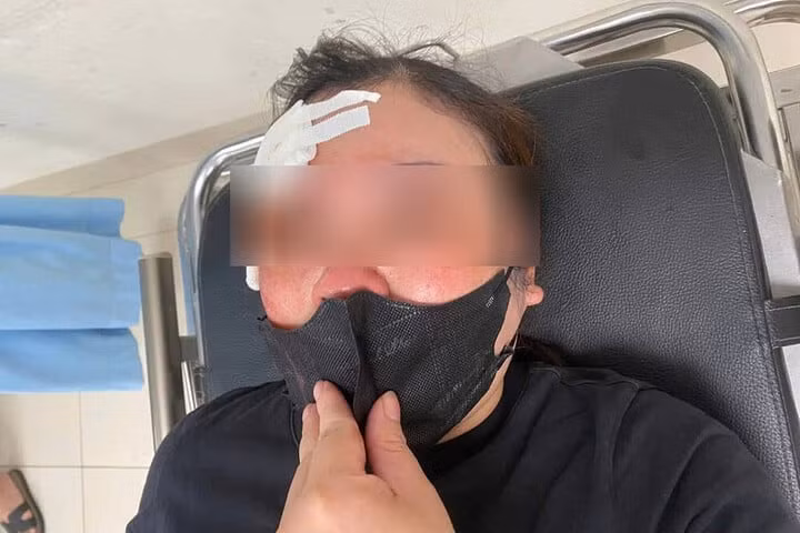 Nguoi phu nu bi tai xe dung dui cui vut vao dau
