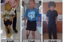 Cắt rễ thần kinh chọn lọc mở cơ hội cải thiện vận động cho trẻ bại não
