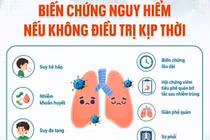 Adenovirus tăng gấp 3 lần, nhiều trẻ lây chéo sau khi học bơi