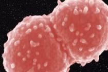 Sinh vật ‘bất tử’ Deinococcus radiodurans làm giới khoa học phải viết lại giới hạn sống