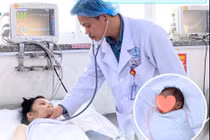 Ho, sốt 3 ngày, sản phụ 32 tuần nguy kịch vì suy hô hấp nặng