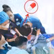 Ung thư hạ họng, bệnh nhân nguy kịch vì viên thuốc mắc đường thở