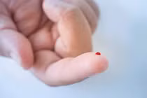Khi nào nên xét nghiệm DNA để phòng bệnh?