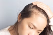 Nguyên nhân gây rụng tóc ở phụ nữ, khắc phục thế nào?