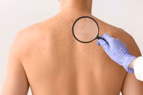 Phòng ung thư da, lão hóa sớm từ bên trong