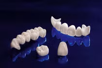 Biến chứng khi làm răng sứ giá rẻ