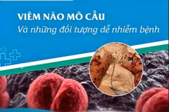 Nguy cơ bùng phát viêm não mô cầu trong cộng đồng, cách gì ngăn ngừa?