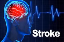 Dấu hiệu cảnh báo sớm cơn đột quỵ nhiều người bỏ qua