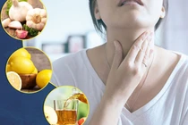 Thực phẩm tốt cho người bị bướu cổ