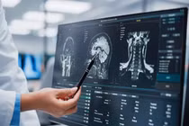 Đau bụng tiêu chảy liên tục, phát hiện loại ký sinh trùng đáng sợ trong não