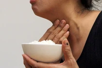 Làm gì để cải thiện tình trạng khó nuốt sau đột quỵ?