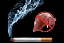 Hút thuốc lá – Cảnh báo nguy cơ xơ gan, ung thư gan