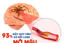 Mỡ máu Tâm Bình – đột phá mới cho người mỡ máu cao