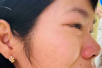 Đắk Nông: Thầy giáo đến nhà hành hung nữ đồng nghiệp