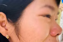 Đắk Nông: Thầy giáo đến nhà hành hung nữ đồng nghiệp