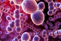 Cách đề phòng nhiễm vi khuẩn liên cầu lợn khi chế biến thực phẩm