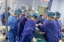 Lấy khối u giáp khổng lồ 15 năm đè ép khí quản