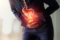 Ung thư đại tràng: Ai dễ mắc, triệu chứng thường gặp là gì?