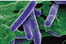 Các bác sĩ TP HCM điều trị bệnh nhân ngộ độc botulinum 