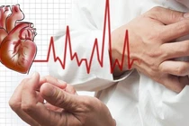 3 cách đơn giản nhận biết đột quỵ bạn cần nắm chắc