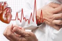 3 cách đơn giản nhận biết đột quỵ bạn cần nắm chắc